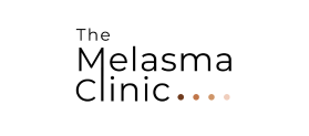 Melasma clinic faqs